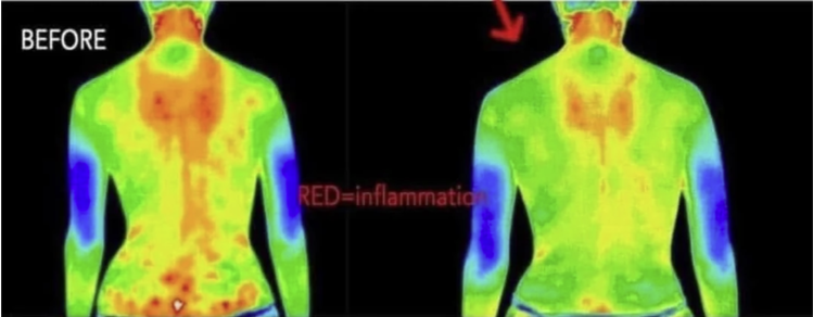 Aeon Fra Lifewave arbejder med inflammation